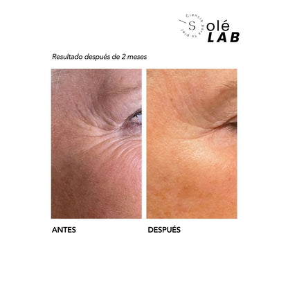NANO RETINOL ENCAPSULADO SOLE PARIS